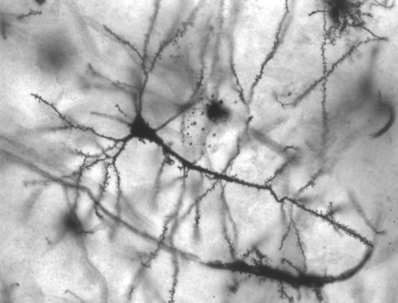 Golgi-stained pyramidal neuron from the human hippocampus under a microscope, showing its branching dendrites